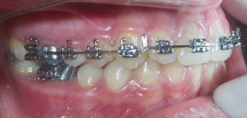 ortodontie cluj